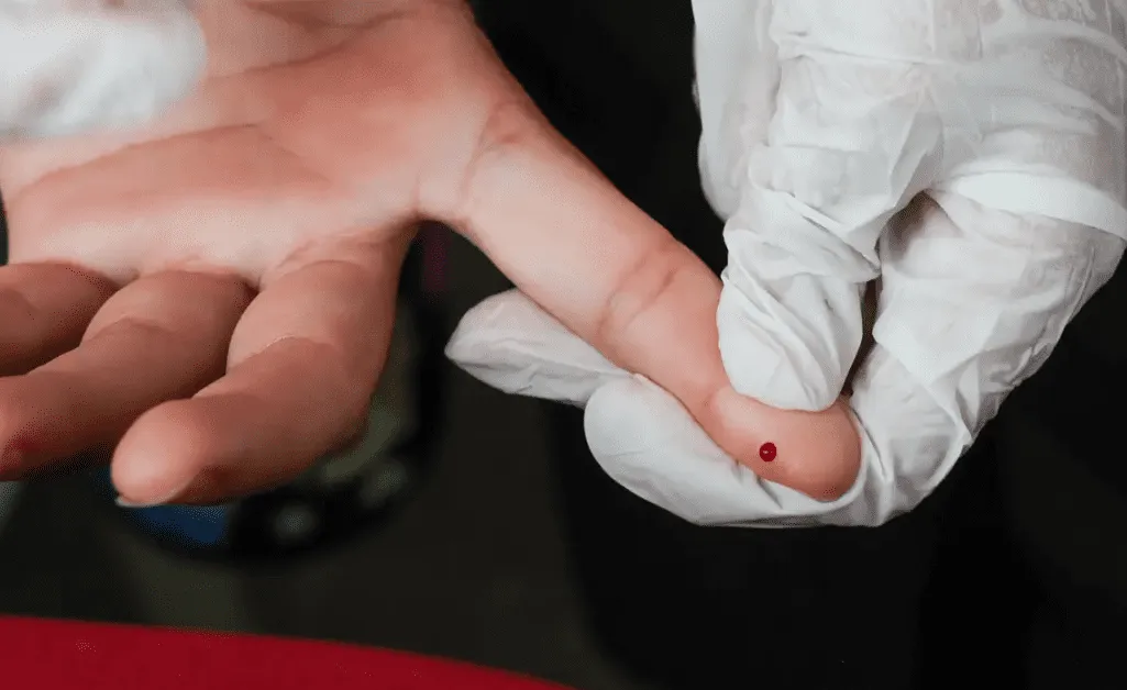 SUS disponibiliza teste rápido para diagnóstico de dengue em todo o Brasil