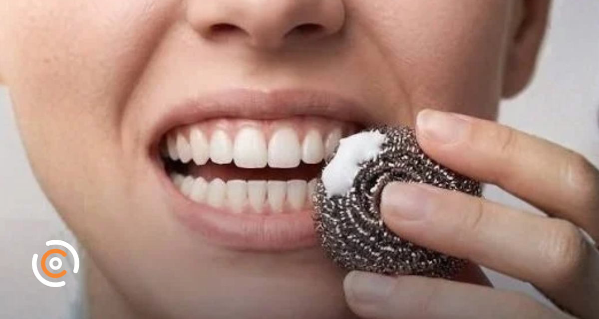 Uso de palha de aço nos dentes? Conselho de Odontologia alerta para riscos da prática divulgada nas redes sociais