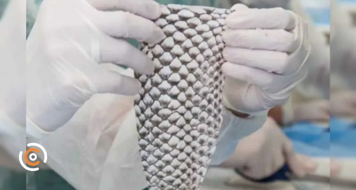 Brasil terá primeira fábrica do mundo de pele de tilápia para tratar queimaduras