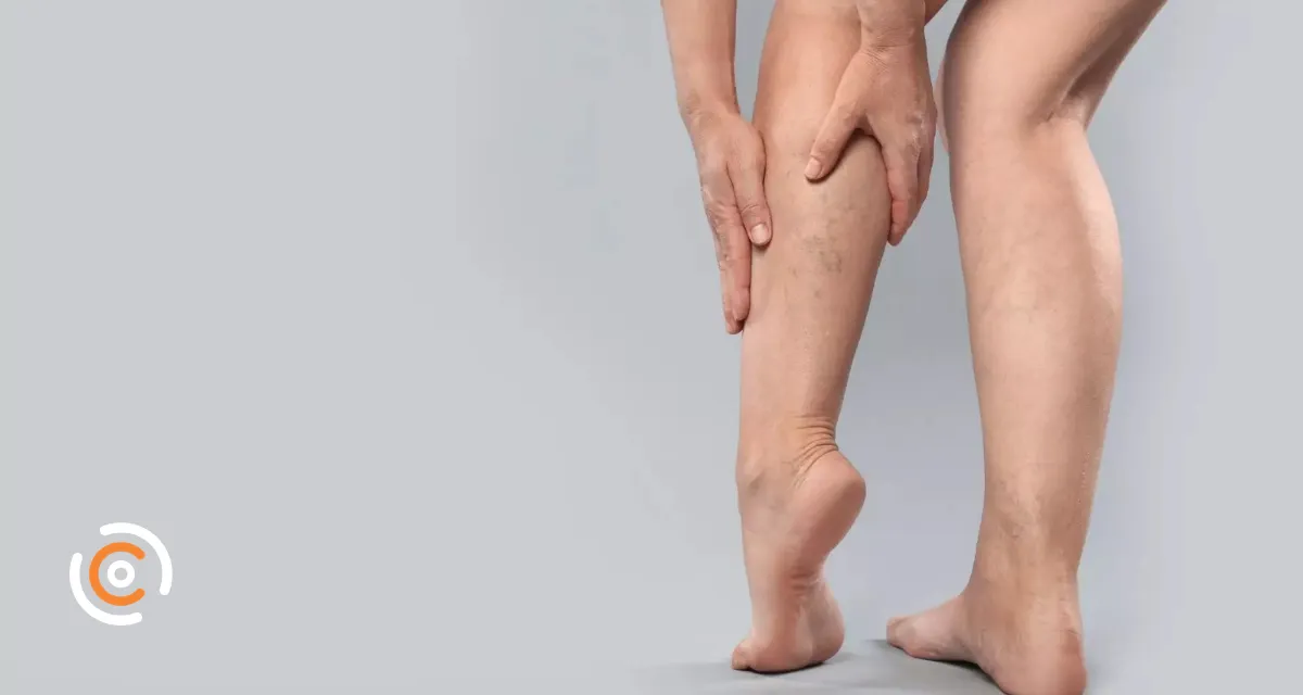 Dia Mundial da Trombose alerta para fatores de risco e cuidados preventivos